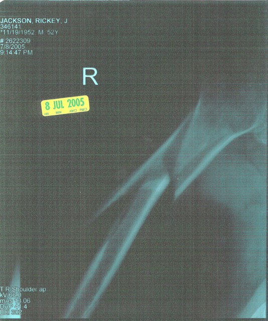 arm02.jpg