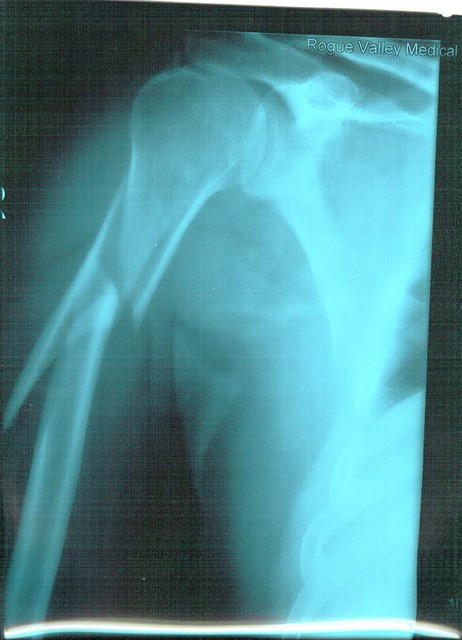 arm05.jpg